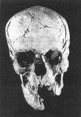 Male Skull, Frontal View, Grave 24